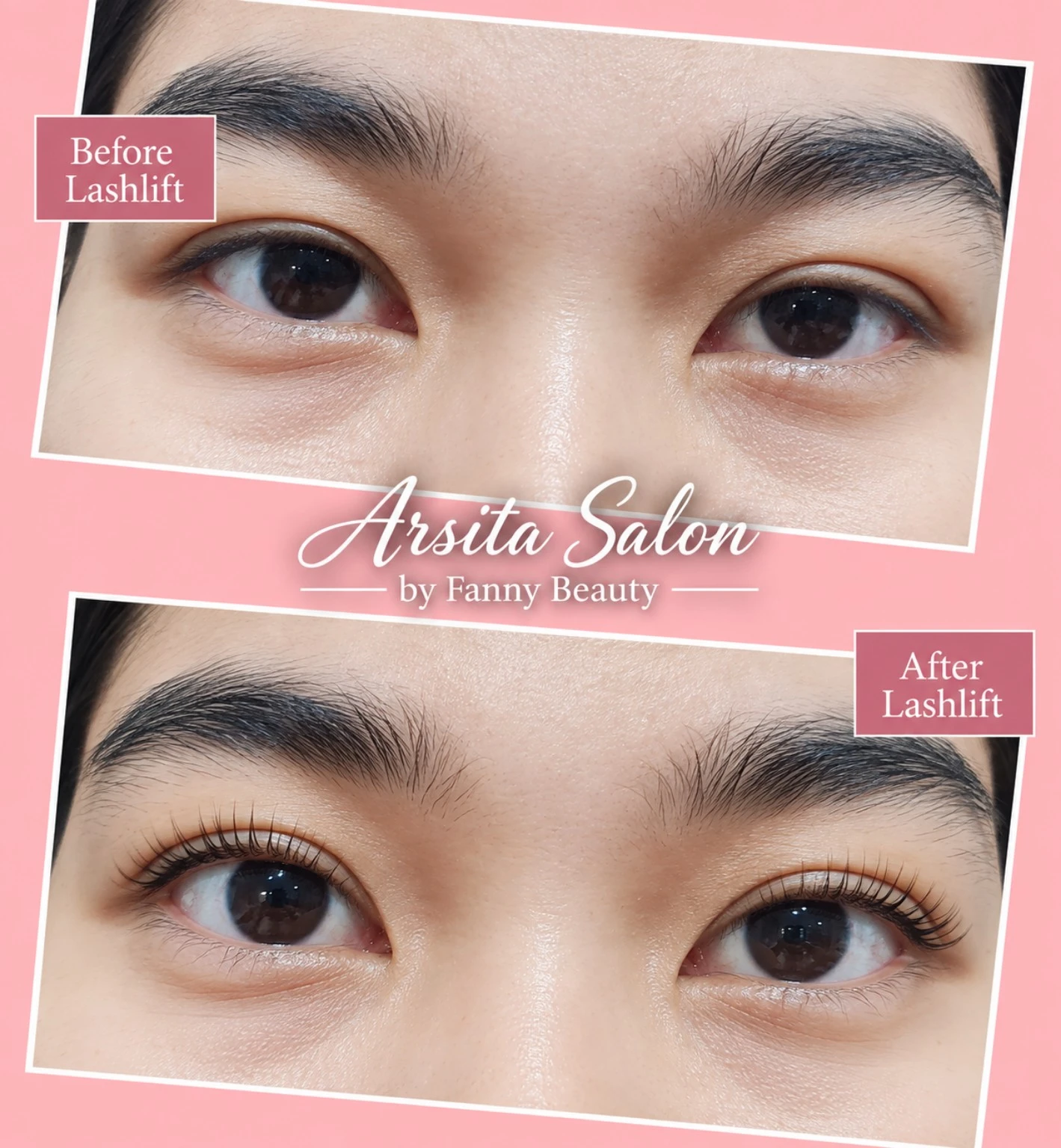 Kolase dua foto area mata dengan label Before Lashlift dan After Lashlift.
