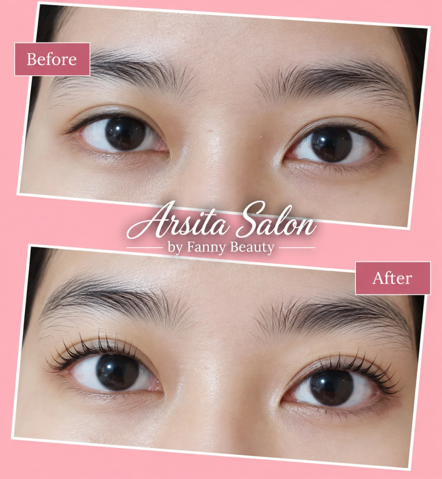 Dua close-up area mata berlabel Before dan After, dengan logo Arsita Salon.