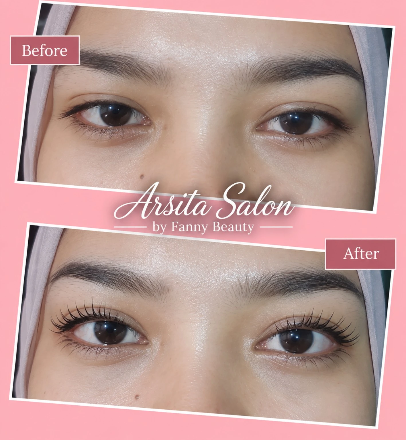 Dua foto close-up area mata berlabel Before dan After, dengan logo Arsita Salon.