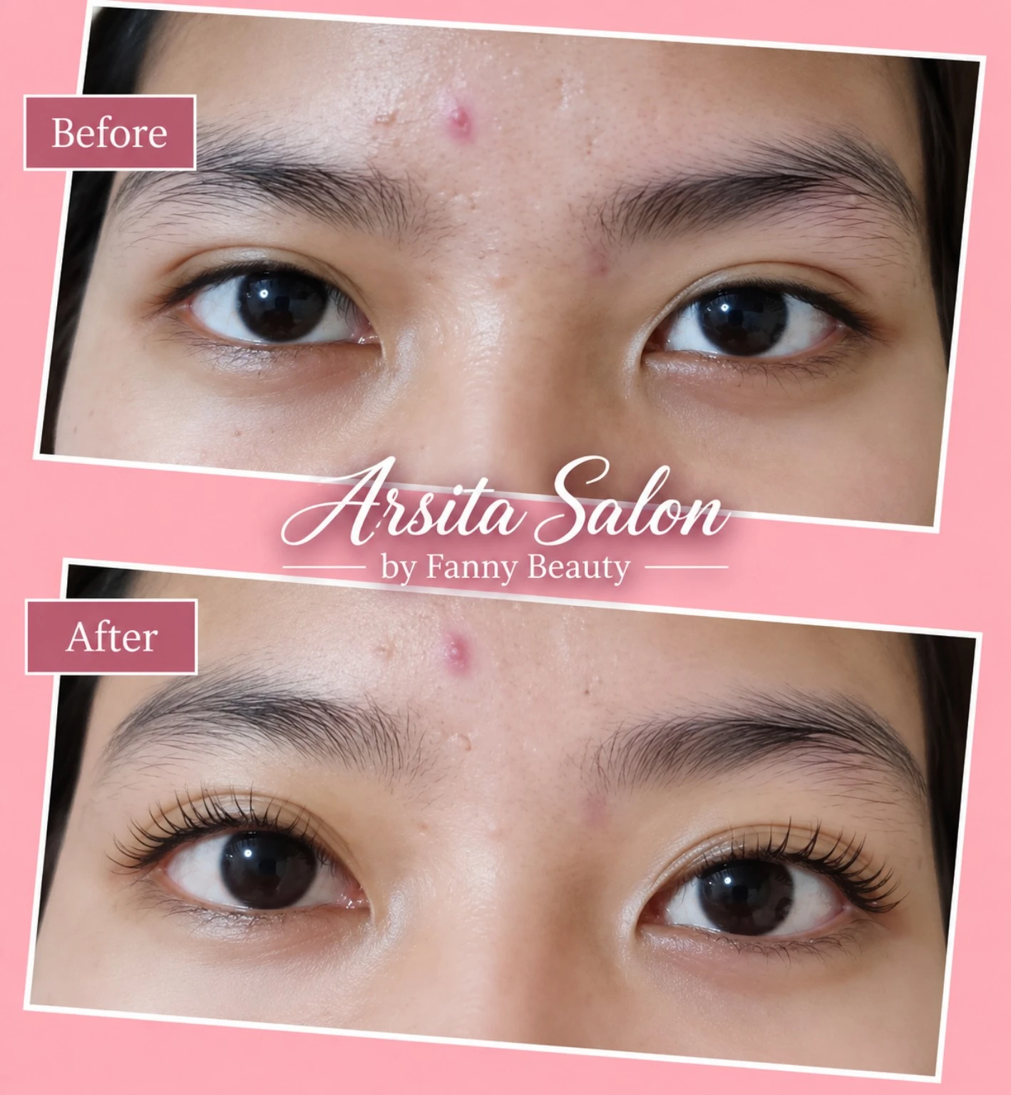 Kolase dua foto area mata berlabel Before dan After, dengan logo Arsita Salon.